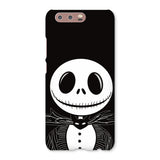 NBC Jack Phone Case