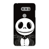 NBC Jack Phone Case